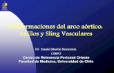 Malformaciones del arco aórtico: Anillos y Sling Vasculares · Anillos y Sling vasculares • 1-2 % Malformaciones arco aórtico • 50 % asociado a malformaciones cardiológicas