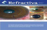 Corneal Lifting: Nuevo abordaje en el tratamiento de la ... · para el tratamiento de ectasias de alta asfericidad | Cálculo del poder del lente intraocular en pacientes con cirugía