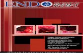 Doença Celíaca com Elevação Hemorragia Digestiva Alta IV … · 2018-01-07 · “Hemorragias por varizes do recto”, da autoria de: Ana Caldeira, Tristan J., Banhudo A. Serviço