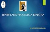 HIPERPLASIA PROSTATICA BENIGNA · En la clínica, el término de hiperplasia prostática benigna (HPB) puede significar cualquiera de las 3 siguientes condiciones: a) Detección microscópica