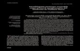 Encefalopatía posterior reversible como primera manifestación … · 2012. 11. 6. · 1316 Casos ClíniCos Rev Med Chile 2012; 140: 1316-1320 Encefalopatía posterior reversible