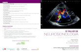poNeNtes - AMN Asociación Madrileña de Neurología · 2017. 9. 15. · 10:30 duplex de tsa: patología de la pared del vaso, análisis de la placa, espesor íntima-media Dra. P.