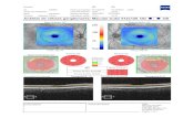 Análisis de células ganglionares: Macular Cube 512x128OD OS · 07/12/2016 CZMI Resumen de un sólo ojo: Ojo izquierdo OD OS Intensidad señal: Hora del examen: Fecha de examen: