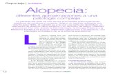 Reportaje | alopecia Alopecia - bellezaMÉDICA...AutotrAspLAnte de peLo El Dr. Vila-Rovira explica que “existen varias alternativas al problema de la calvi-cie. El único método
