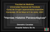 Presentación de PowerPoint...Curso de Cirugía Laparoscópica avanzada Corrientes, 29 de Mayo al 2 de Junio, 2007. "Hernias Hiatales Paraesofágicas" Demetrio Cavadas Hospital Italiano