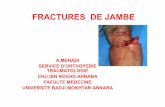 FRACTURES DE JAMBE - cours-examens.org€¦ · La fracture de jambe est, ici, consécutive à un choc survenant loin de la jambe. Ce choc provoque deux types de contraintes: Contraintes