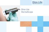 Dino-Lite DermaScope€¦ · Con el lanzamiento de Dino-Lite DermaScope® , los clientes podrán disfrutar de una nueva generación de dermatoscopios compactos y económicos.