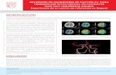 Poster Investigaciones ACV - Clínica Shaio€¦ · Caso No 1. Paciente de 87 años, hipertenso, con reemplazo valvular mitral y aórtico biológico y ﬁbrilación auricular, toma