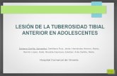LESIÓN DE LA TUBEROSIDAD TIBIAL ANTERIOR EN ... 2013/PDF/P-21.pdfIntroducción ! Las lesiones por avulsión de la tuberosidad tibial anterior (TTA) son fracturas infrecuentes, suponiendo