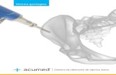 Técnica uirúrgica - Acumed · incisión de 2 cm situada sobre la cresta ilíaca, al menos a 3 cm por detrás de la espina ilíaca anterior superior (EIAS) a fin de proteger el nervio