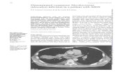 GenitourinMed Disseminated MycobacteriumAIDSGenitourinMed1995;71:308-310 DisseminatedcutaneousMycobacterium tuberculosis infection in apatientwithAIDS ELCorbett, I Crossley, KMDeCock,RFMillerCited