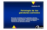Patología de las glándulas salivales · PATOLOGPATOLOGÍA DE LAS GLÁNDULAS SALIVALESÍA DE LAS GLÁNDULAS SALIVALES DIAGNÓSTICO uHistoria y exploración clínica – tumefacción:
