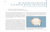 21 radiología convencional · 2013. 10. 23. · Inflamación de los tejidos blandos. La tumefacción de los tejidos blandos que rodean una articulación sinovial se reconoce en los