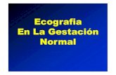 Ecografia En La Gestación Normal...1.- Diagnosticar la gestación y correcta implantación 2. -Valorar el numero de embriones y, en caso de gestación múltiple, Primer Trimestre