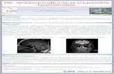 P484 - Adrénoleucodystrophie révélée par un hypogonadisme hypogonadotrophique · 2018. 9. 2. · P484 - Adrénoleucodystrophie révélée par un hypogonadisme hypogonadotrophique