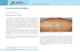 Dermatosis invisibles · 2020. 2. 5. · Dermatosis invisible No. 4: Dermatitis cenicienta. Fuente: Publica Cuadro resumen. Vitiligo. Clínica Parches despigmentados (“blancos”).