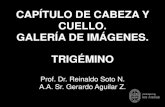 CAPÍTULO DE CABEZA Y CUELLO. GALERÍA DE ...#769...Nervio abducens Nervio oculomotor Visión superior de fosa craneal media y posterior: Relaciones nerviosas. Nervios del foramen