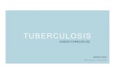 TUBERCULOSIS - AEPap · 2020. 3. 24. · se puede completar tratamiento anti-TB con isoniacida, rifampicina y etambutol. o Se puede optar por un régimen con fármacos anti-TB no