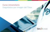 Diplomado Diagnóstico por Imagen del Tórax · biomarcadores de imagen, el TC de doble energía y los estudios multiparamétricos en radiología. Este Diplomado en Diagnóstico por