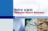 Valvular Heart Diseaseelearning.kocw.net/KOCW/document/2015/bible/choieunhee/7.pdf · 2016. 9. 9. · 판막질환 후천성 판막질환의 원인 류마티스 열이 가장 흔한