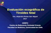 Evaluación ecográfica de Tiroides fetal