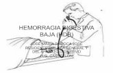 HEMORRAGIA DIGESTIVA BAJA (HDB) - gva.es