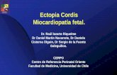 Ectopia Cordis Miocardiopatía fetal.