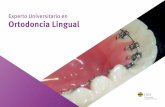 Experto Universitario en Ortodoncia Lingual