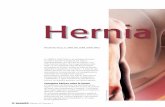 Hernia inguinal. La lucha contra la profusión