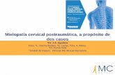 Mielopatía cervical postraumática, a propósito de dos casos