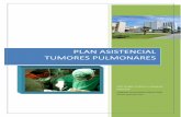 plan asistencial tumores pulmonares nov15