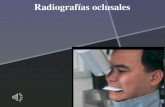 Radiograf­as oclusales